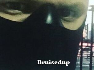 Bruisedup