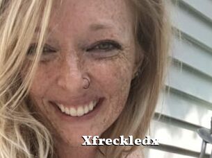Xfreckledx